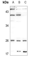 1 - Anti-CMPK1 Antibody AP60555