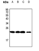 1 - Anti-CMTM3 Antibody AP60556