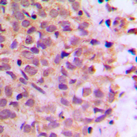 19 - Anti-Zeta COP Antibody AP60557