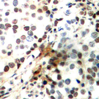 19 - Anti-CREB (Phospho-S142) Antibody AP60558