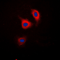 3 - Anti-Catenin delta 1 (Phospho-Y228) Antibody AP60559