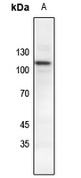 1 - Anti-Catenin delta 1 (Phospho-Y228) Antibody AP60559