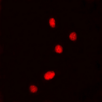 3 - Anti-DDX5 (Phospho-Y593) Antibody AP60560