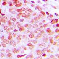 19 - Anti-DDX5 (Phospho-Y593) Antibody AP60560