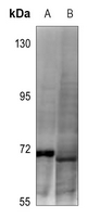 1 - Anti-DDX5 (Phospho-Y593) Antibody AP60560