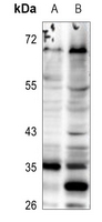 1 - Anti-ELOVL5 Antibody AP60562