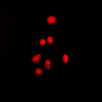3 - Anti-Estrogen Receptor beta (Phospho-S105) Antibody AP60563