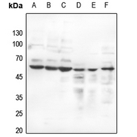 1 - Anti-Estrogen Receptor beta (Phospho-S105) Antibody AP60563