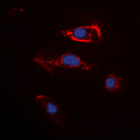 3 - Anti-FGF22 Antibody AP60564