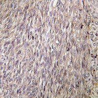 19 - Anti-FGF22 Antibody AP60564