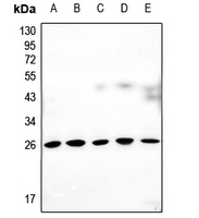 1 - Anti-Connexin 25 Antibody AP60565