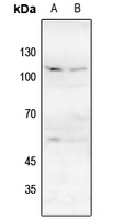 1 - Anti-NMDAR1 (Phospho-S896) Antibody AP60569