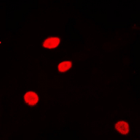 3 - Anti-Histone H2A.Z (Acetyl-K5) Antibody AP60570