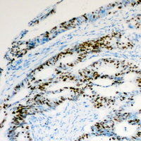 19 - Anti-Histone H2A.Z (Acetyl-K5) Antibody AP60570