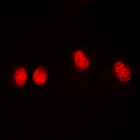 3 - Anti-Histone Deacetylase 3 (Phospho-S424) Antibody AP60571