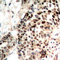 19 - Anti-Histone Deacetylase 3 (Phospho-S424) Antibody AP60571