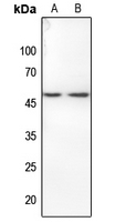 1 - Anti-Histone Deacetylase 3 (Phospho-S424) Antibody AP60571