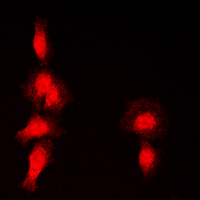 3 - Anti-Histone Deacetylase 7 (Phospho-S155) Antibody AP60572