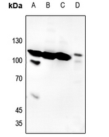 1 - Anti-Histone Deacetylase 7 (Phospho-S155) Antibody AP60572