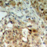 19 - Anti-hnRNP K Antibody AP60573