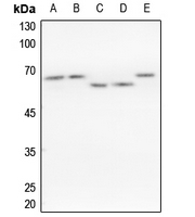 1 - Anti-hnRNP K Antibody AP60573