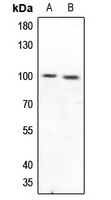 1 - Anti-CD210a Antibody AP60574