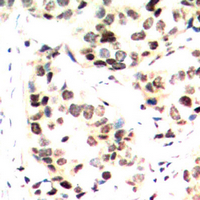 19 - Anti-c-Jun (Phospho-S243) Antibody AP60577