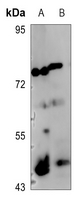 1 - Anti-c-Jun (Phospho-S73/100) Antibody AP60578