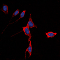 3 - Anti-Kir3.1 Antibody AP60579