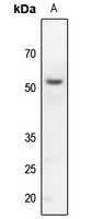 1 - Anti-Kir3.1 Antibody AP60579