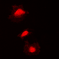 3 - Anti-KIF2C (Phospho-S95) Antibody AP60580