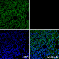 19 - Anti-KIF2C (Phospho-S95) Antibody AP60580