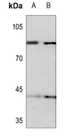 1 - Anti-KIF2C (Phospho-S95) Antibody AP60580