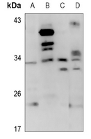 1 - Anti-CD159a Antibody AP60581