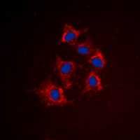3 - Anti-Cytokeratin 8 (Phospho-S432) Antibody AP60582