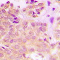 19 - Anti-Cytokeratin 8 (Phospho-S432) Antibody AP60582