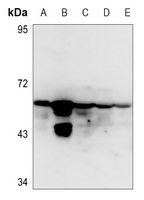 1 - Anti-Cytokeratin 8 (Phospho-S432) Antibody AP60582