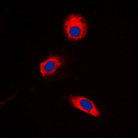 3 - Anti-MKK3 (Phospho-T222) Antibody AP60583