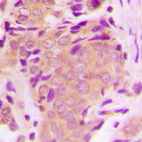 19 - Anti-TAK1 (Phospho-T184) Antibody AP60585