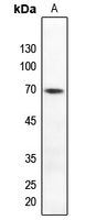 1 - Anti-TAK1 (Phospho-T184) Antibody AP60585