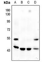 1 - Anti-JNK1/2/3 (Phospho-T183/Y185) Antibody AP60586