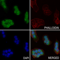 3 - Anti-TAU (Phospho-T522) Antibody AP60587