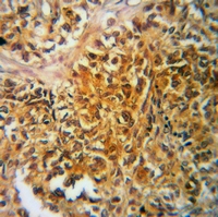 19 - Anti-TAU (Phospho-T522) Antibody AP60587