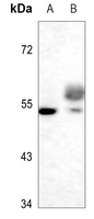1 - Anti-TAU (Phospho-S721) Antibody AP60588