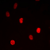 3 - Anti-TRAP100 Antibody AP60590