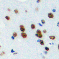 19 - Anti-TRAP100 Antibody AP60590