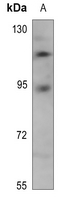 1 - Anti-TRAP100 Antibody AP60590