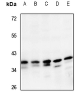 1 - Anti-CRSP8 Antibody AP60591