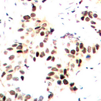 19 - Anti-MEF2A (Phospho-T312) Antibody AP60592