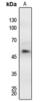 1 - Anti-MEF2A (Phospho-T312) Antibody AP60592